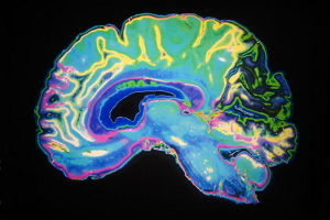 The brain
