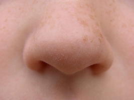 Nose